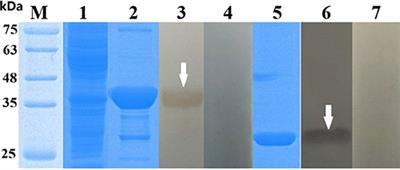 Preliminary Evaluation of Recombinant EPC1 and TPx for Serological Diagnosis of Animal Cystic Echinococcosis